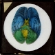 [Diagram of human brain]