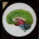 [Cross-section diagram of brain]