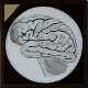 [Cross-section diagram of brain]