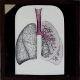 [Diagram of human lungs]