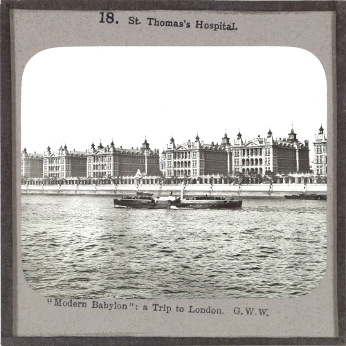 St Thomas's Hospital, London– alternative version