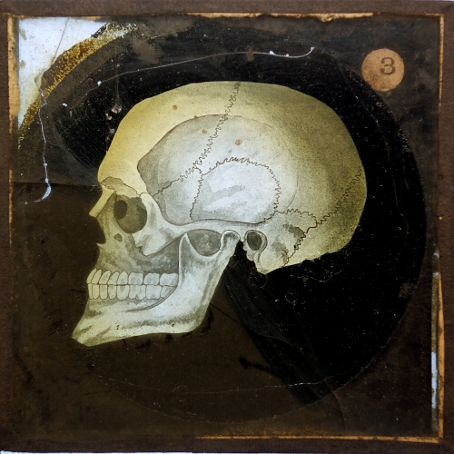 Skull (side view)