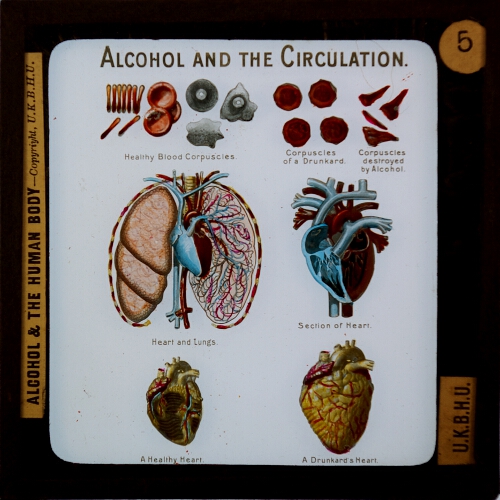 Alcohol and the Circulation