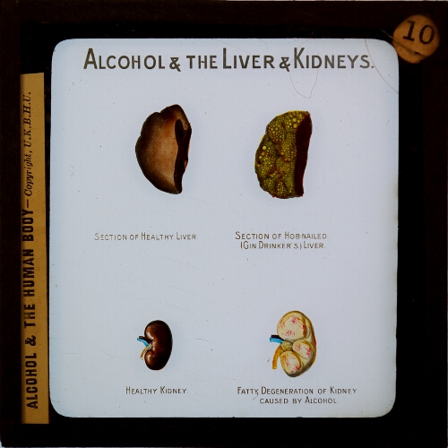 Alcohol and the Liver and Kidneys