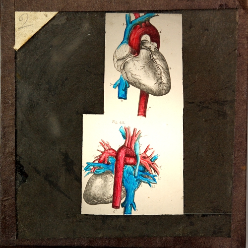 Two diagrams of heart