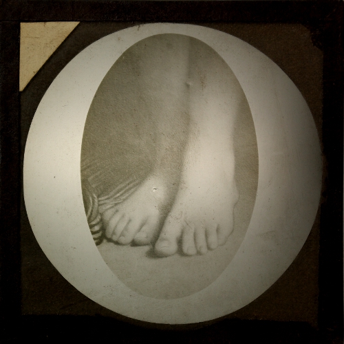 Photograph of pair of human feet