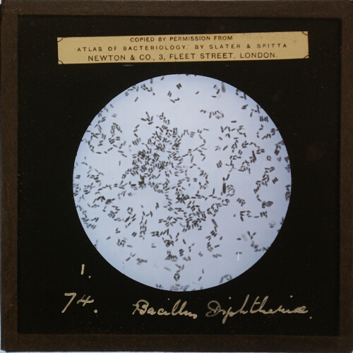 Bacillus Diphtheriae. C.G.P. Gelatin Culture, 72 hours' growth x 1,000