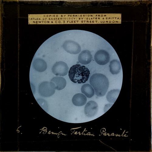 Benign Tertian Parasite, Partially segmented sporocyte, X 1,000 methylene blue