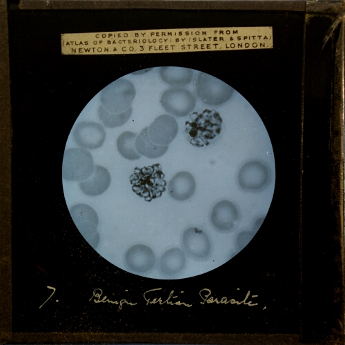 Benign Tertian Parasite, Mature segmented sporocyte, X 1,000, methylene blue