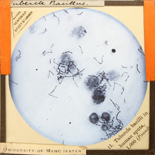 Tubercle bacilli in human sputa, x1,000 (Pound)
