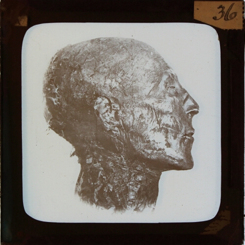 Head of mummified body
