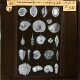 Foraminifera -- Magnified