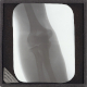 Man's elbow joint